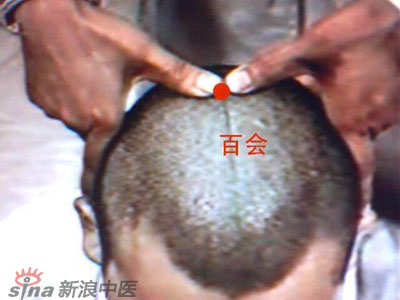 艾灸常用的保健穴有哪些？--百會(huì)