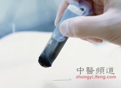 點(diǎn)擊將在新窗口查看全圖 中醫(yī)艾灸養(yǎng)生的十大禁忌