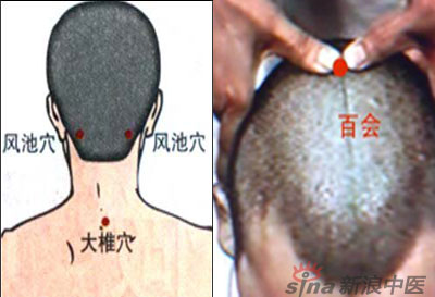 常見(jiàn)病艾灸時(shí)怎樣選穴？--大椎百會(huì)穴