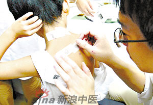灸法的種類  你知道多少？